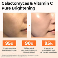 [SOMEBYMI] Galactomyces Suero Puro de Vitamina C