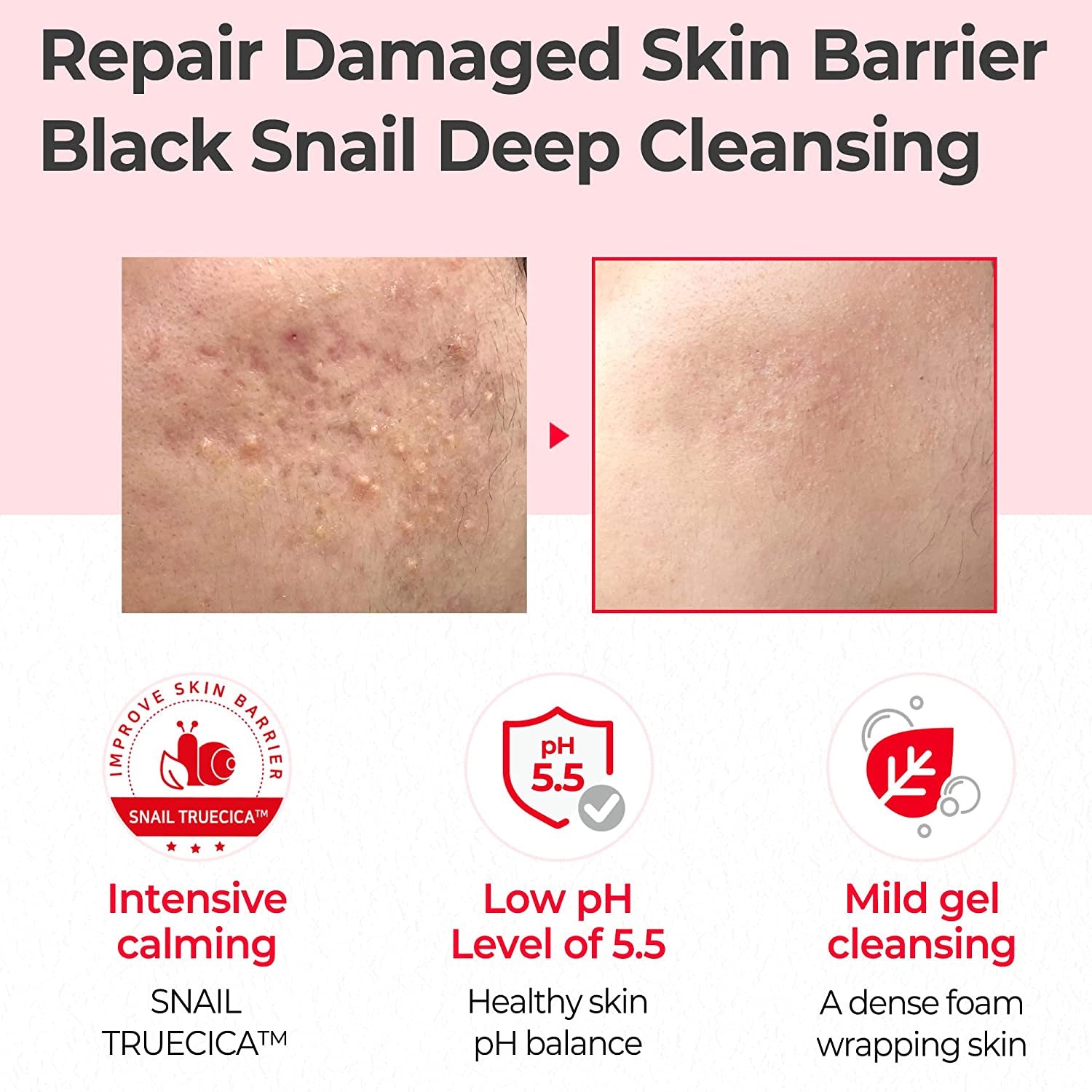 [SOMEBYMI] Caracol Truecica Miracle Repair Gel Limpiador de bajo pH