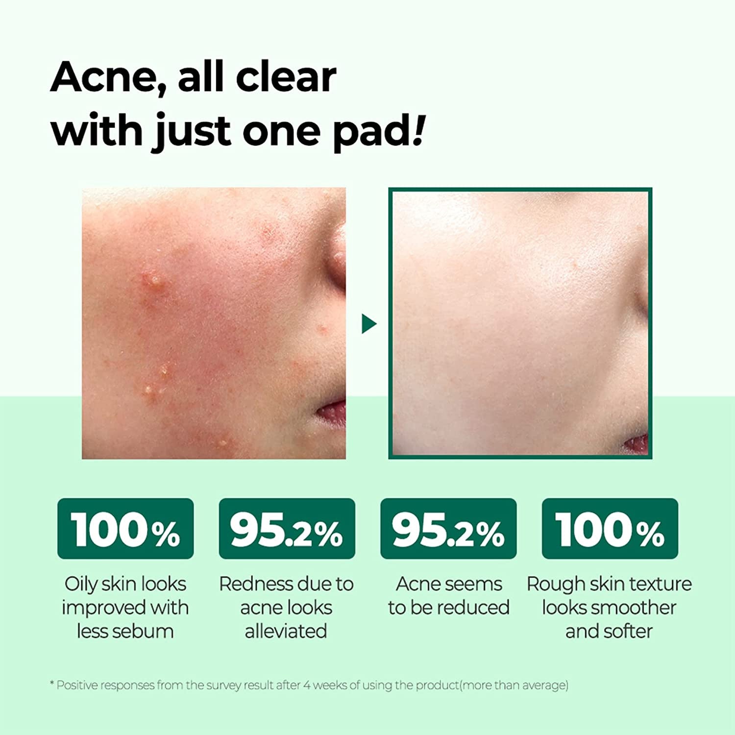 [SOMEBYMI] AHA BHA PHA 30 Días Milagro Truecica Clear Pad