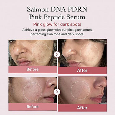 [Medicube] Collagen PDRN Pink Peptide Serum 30ml +Free gift