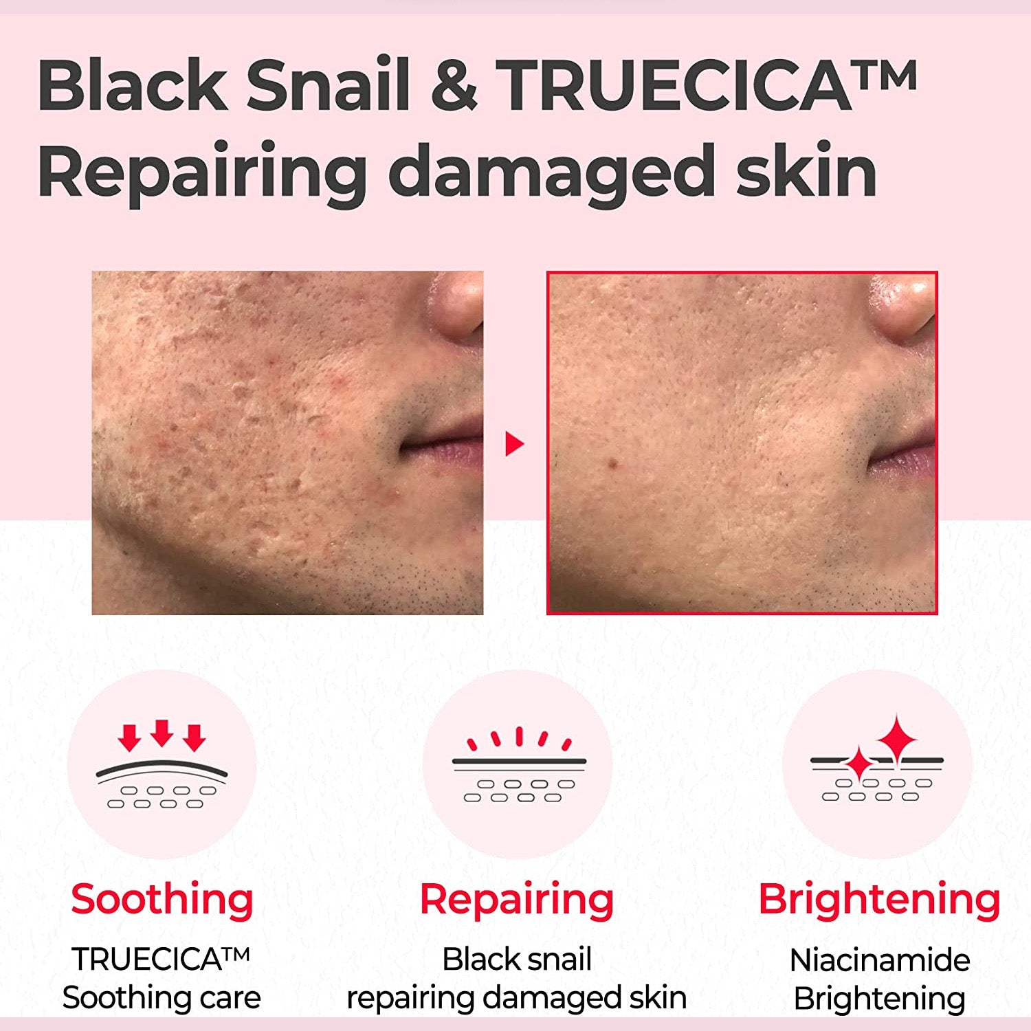 *Flash Deal* [SOMEBYMI] Snail Truecica Miracle Repair Toner 135ml