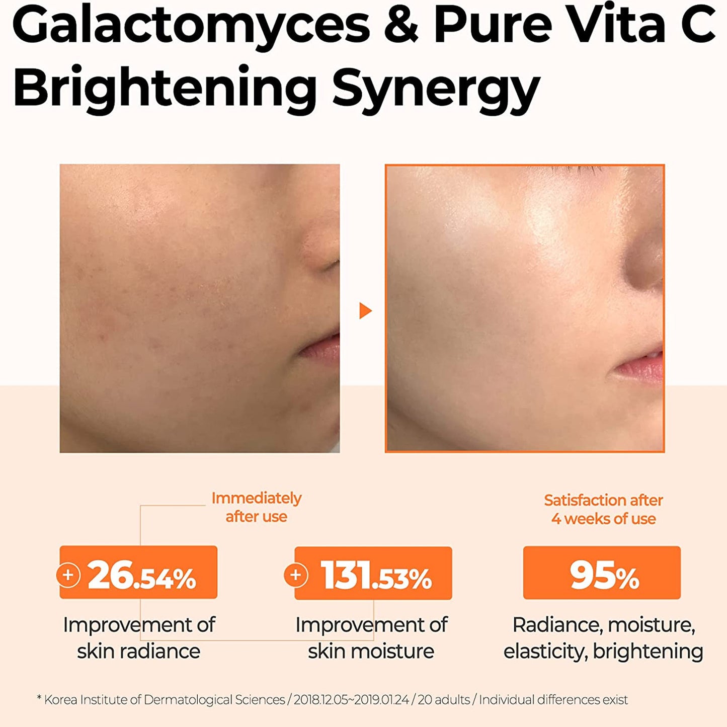 [SOMEBYMI] Galactomyces Pure Vitamin C Glow Toner