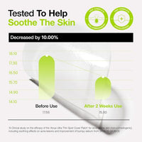 [Anua] Ultra Thin Spot Cover Patch (75ea)