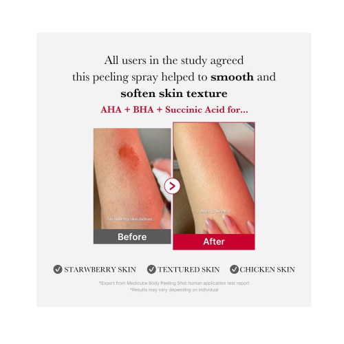 [Medicube] Red Acne Body Peeling Shot 2.0 110ml