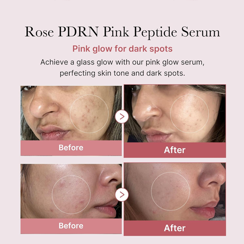 [Medicube] Collagen PDRN Pink Peptide Serum 30ml