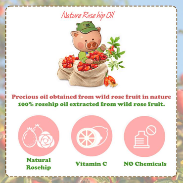 [Elizavecca] Farmer Piggy Rose hip Oil 100% 30ml