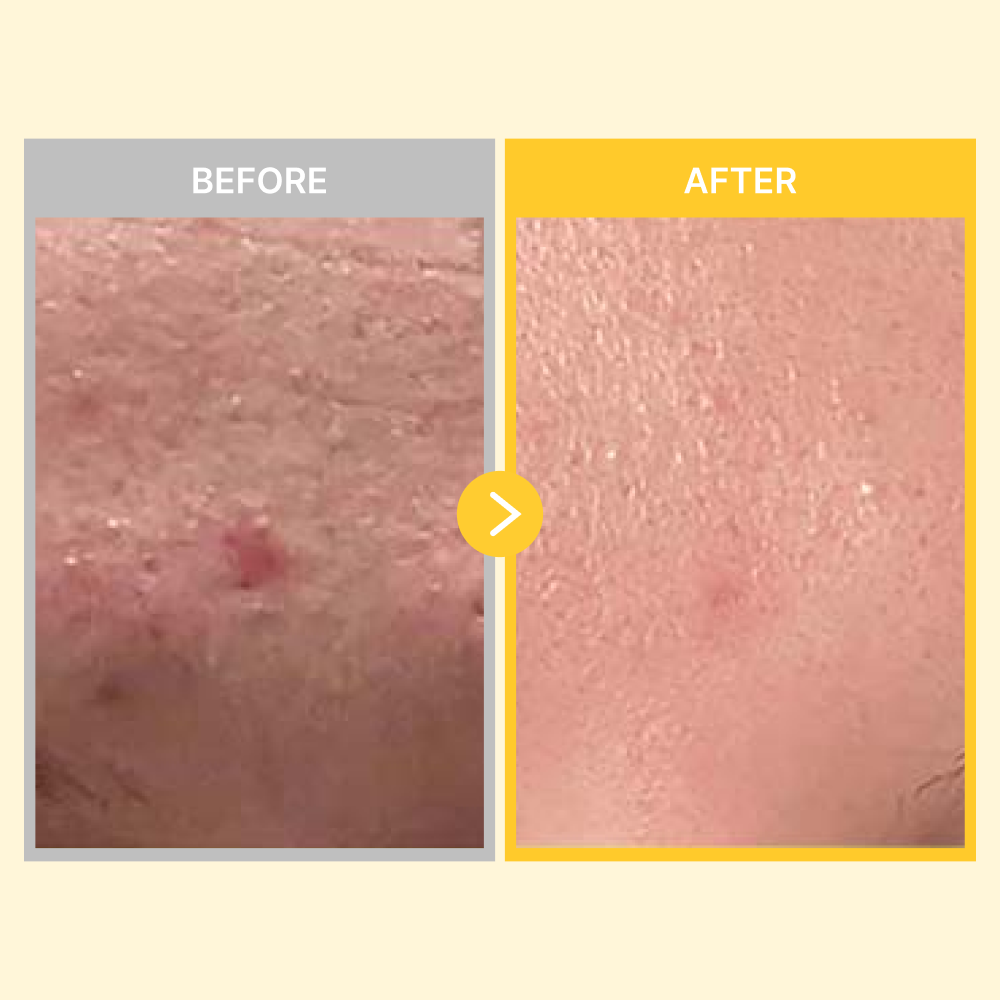 MOIDA SET [COSRX] Snail 96 Mucin Repair Care Routine for Damaged & Dehydrated Skin (Essence + Cream) *Special Price*