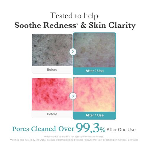 [Medicube] Azelaic Acid Niacinamide Deep Clean Foam Cleanser 120ml
