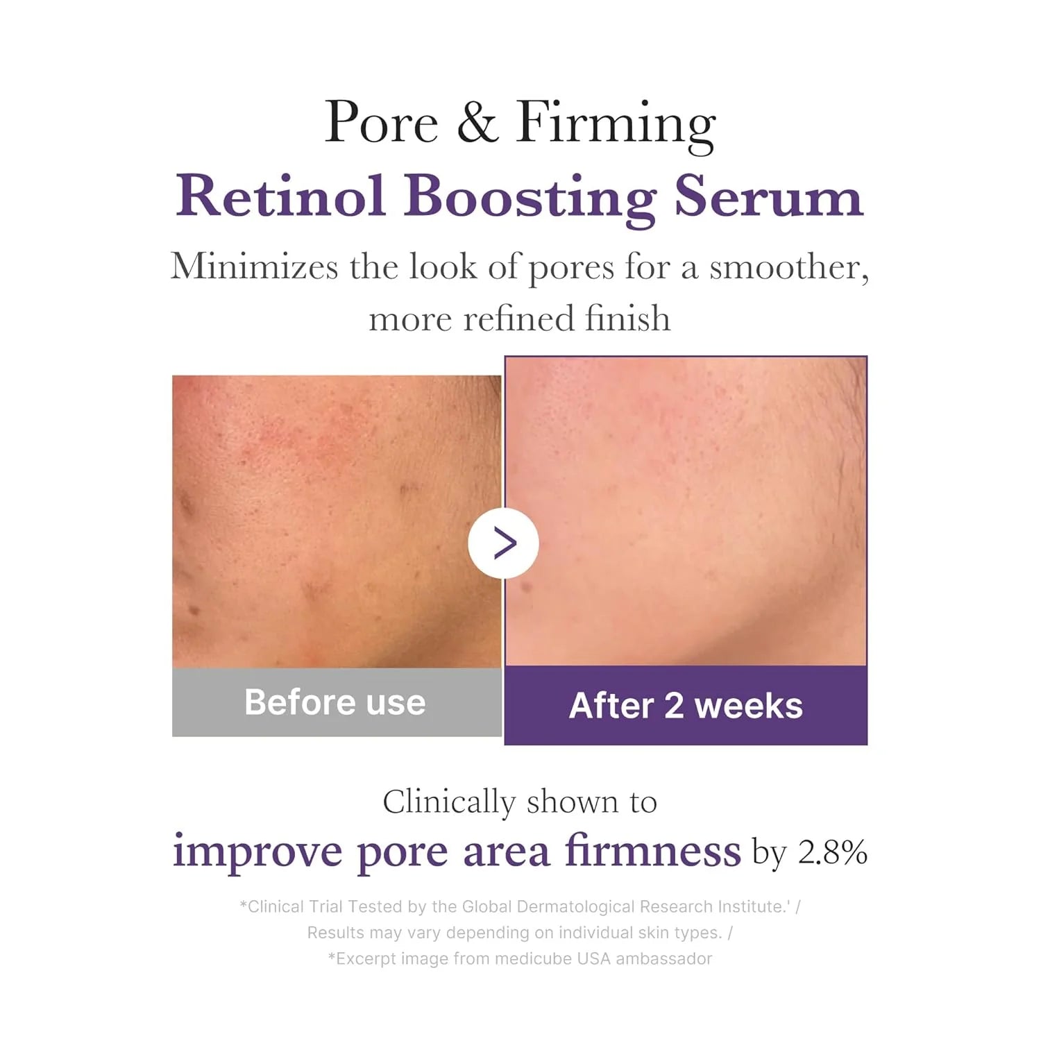 [Medicube] Retinol NMN Boosting Serum 30ml