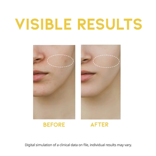 [OOTD] Dark Spot Vitamin C Serum 50ml