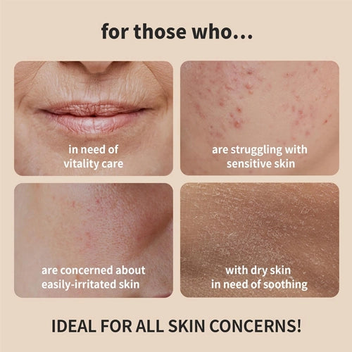 [Benton] *renew* Snail Bee High Content Skin Toner 150ml