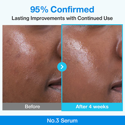 [Numbuzin] No.3 Blue Bio-Retinol Pore Refining Serum 30ml