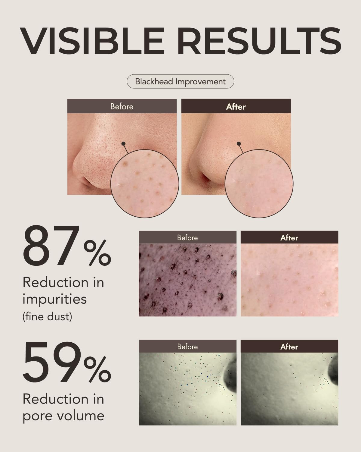 [OBgE] Blackhead Scrub Balm 20g
