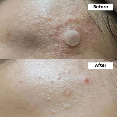 [NINE LESS] A-control 10% Azelaic Acid Serum 30ml