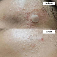 [NINE LESS] A-control 10% Azelaic Acid Serum 30ml