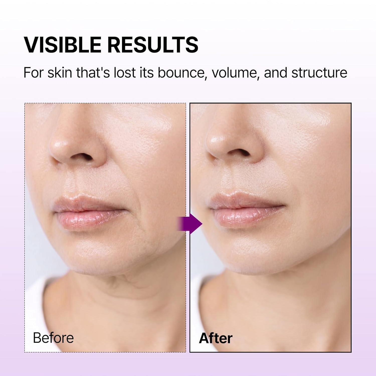 [Dr.Melaxin] Calcium Bonding Facial Cream 100ml