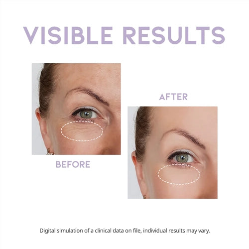 [OOTD] Overnight Eye Cream 25g