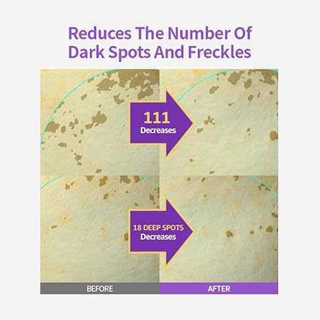 [SUNGBOON EDITOR] Meoru Podo VitaC Dark Spot Ampoule 30ml