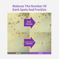 [SUNGBOON EDITOR] Meoru Podo VitaC Dark Spot Ampoule 30ml