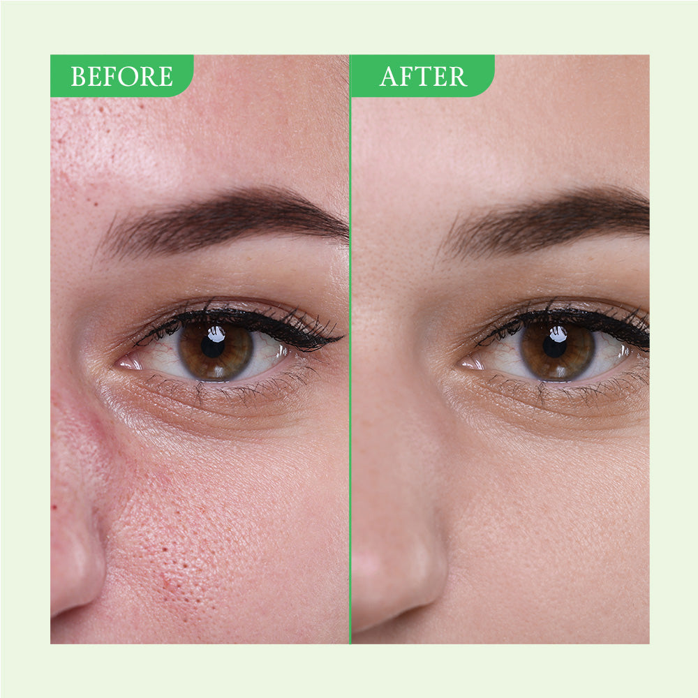 [FULLY] Green Tomato Toner 250ml *Flash Deal*