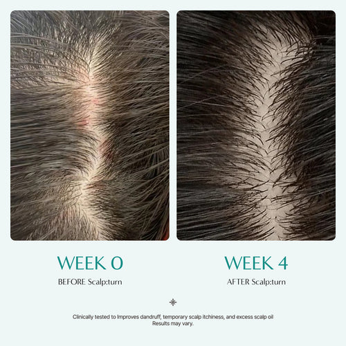 [lilyeve] Scalp:Turn Cica PDRN Brush Ampoule 100ml