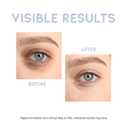 [OOTD] Intensive Eye Serum 30g