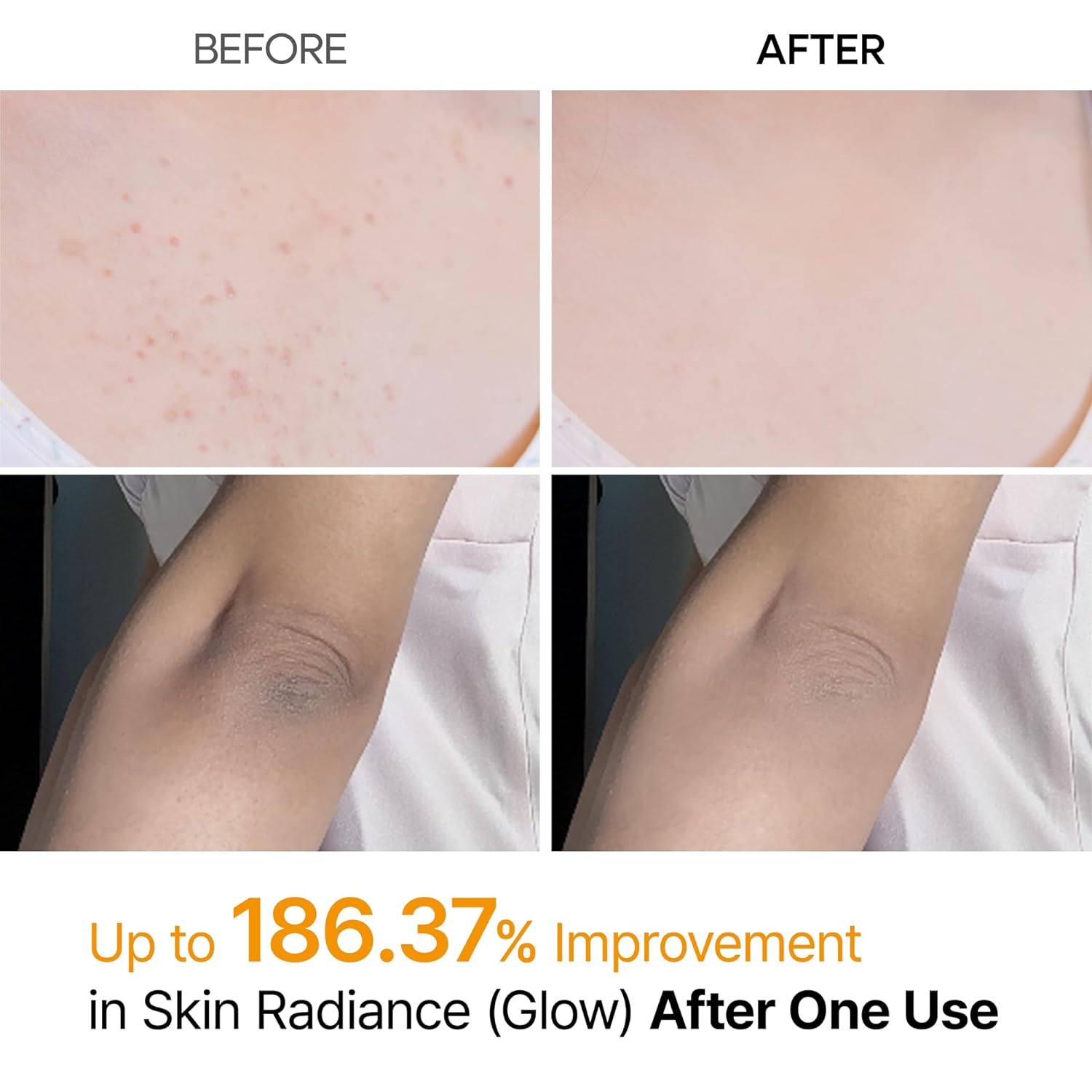 [Dr.Melaxin] Peel Shot Kojic Acid Turmeric Spray 200ml