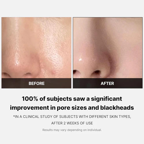 *MOIDA SET* [Medicube] Zero Pore Care Set (Pad + Mud Mask)