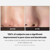 *MOIDA SET* [Medicube] Zero Pore Care Set (Pad + Mud Mask)