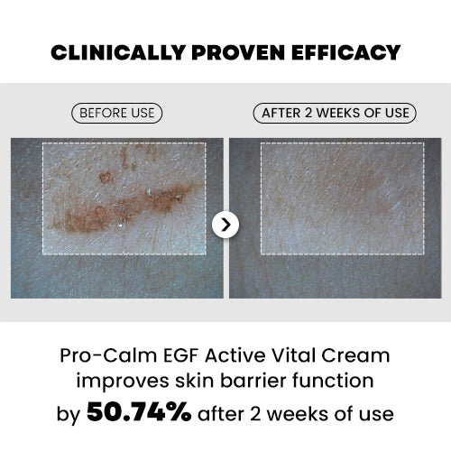 [PRO-CALM] EGF Active Vital Cream 20ml