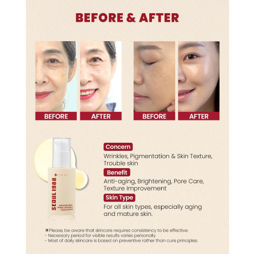 [KSECRET] SEOUL 1988 Serum : Retinal Liposome 2% + Black Ginseng