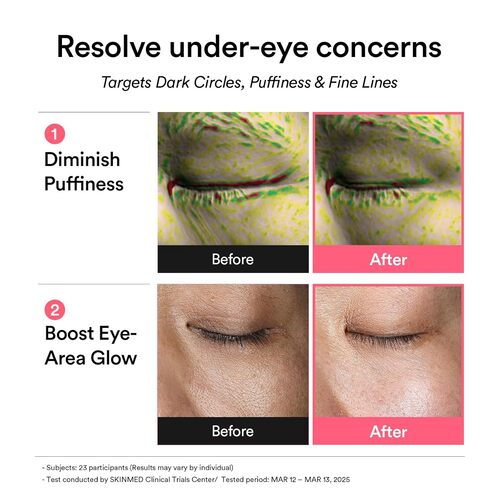[Abib] PDRN Retinal Eye Patch Glow Jelly (60ea)
