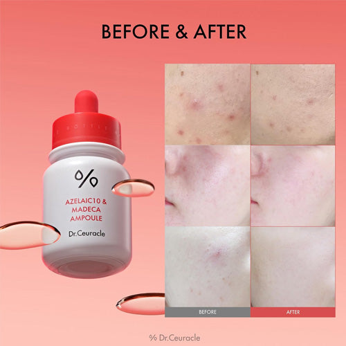 [Dr.Ceuracle] Azelaic10 & Madeca Ampoule 30ml