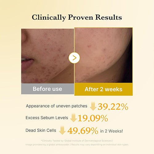 [MEDICUBE] Kojic Acid Turmeric Pad (70ea)