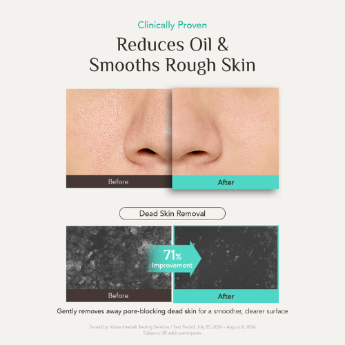 [OBgE] Pore Zero Peeling Toner 310ml