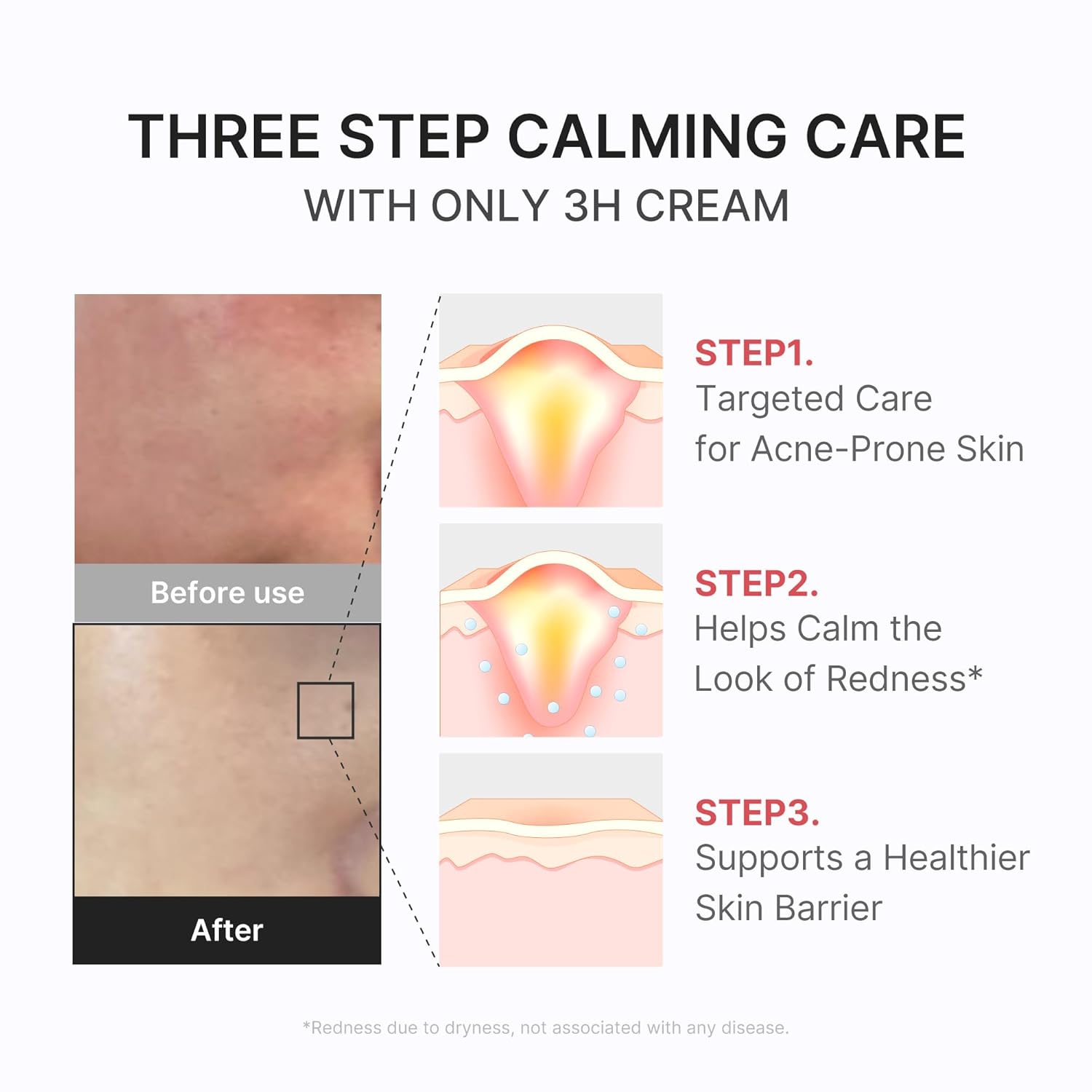 [Medicube] Hypochlorous 3H Relief Cream 50ml