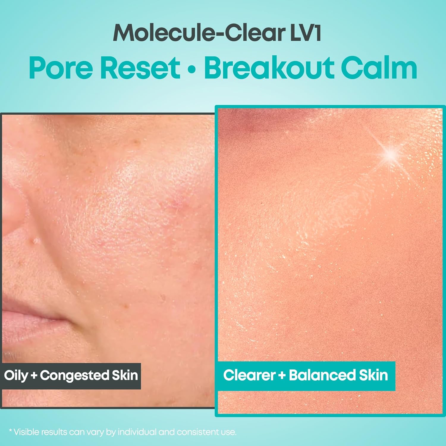 [NINELESS] *renewal* Molecule-Clear Salicylic Acid Serum 30ml