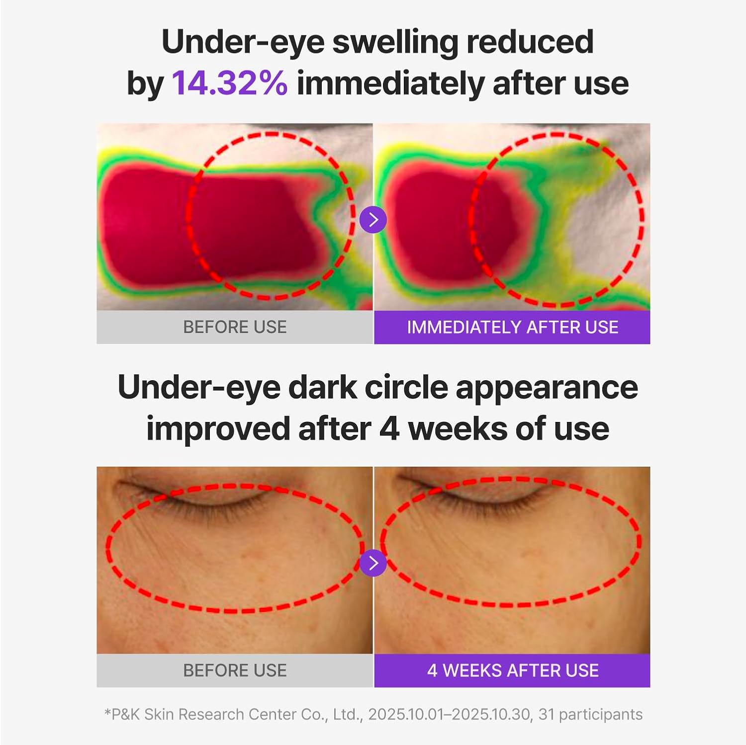 [Centellian24] 360 Shot PDRN Glowing Eye Patch (6ea)