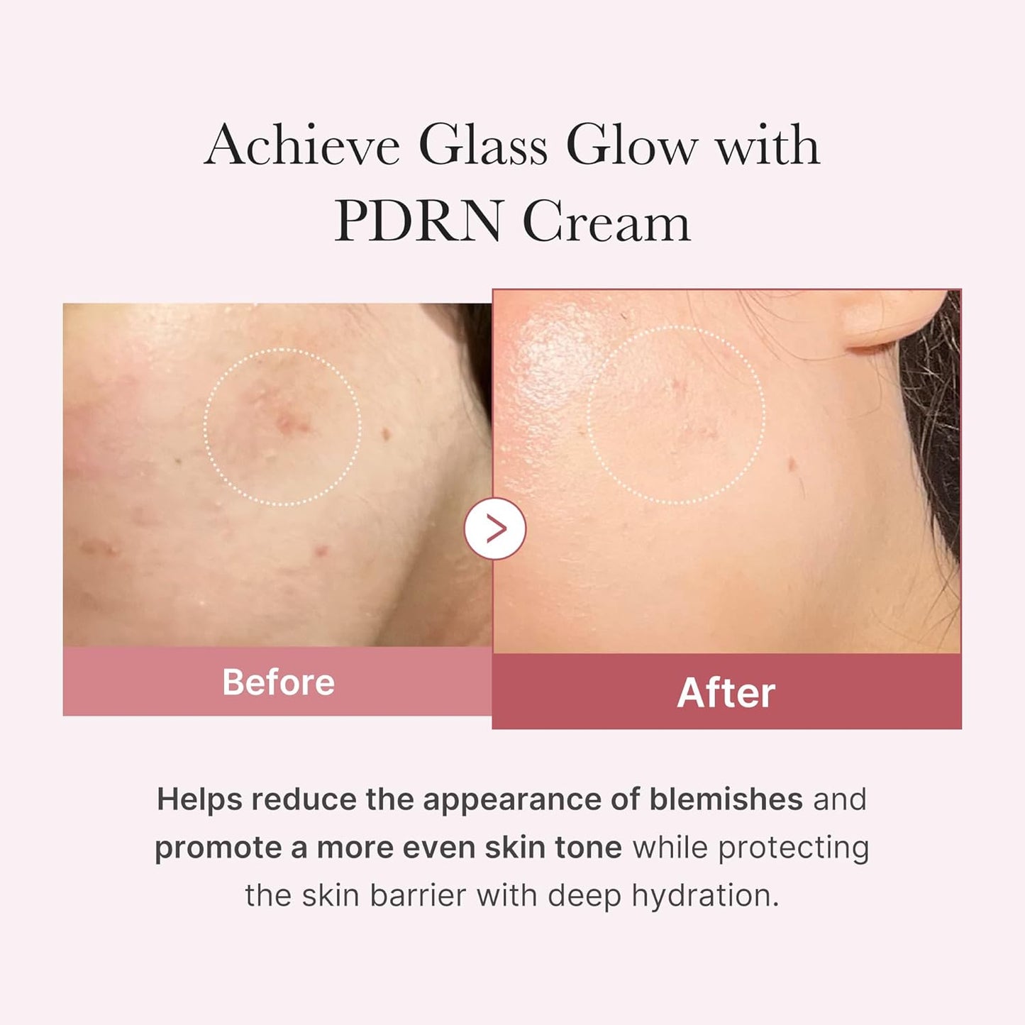 [Medicube] PDRN Pink Hyaluronic Moisturizing Cream 50ml