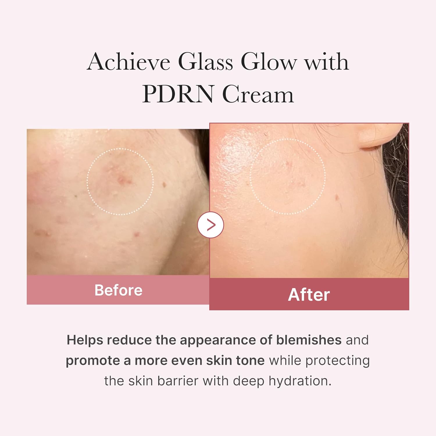 [Medicube] PDRN Pink Hyaluronic Moisturizing Cream 50ml