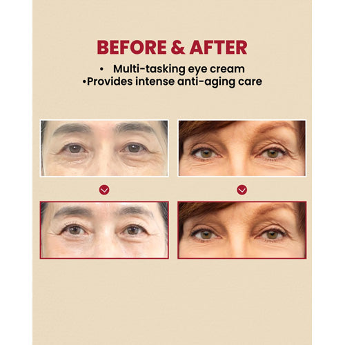 MOIDA SET [KSECRET] SEOUL 1988 Anti-Aging Care Duo (Eye Cream & Serum) *Special Price*