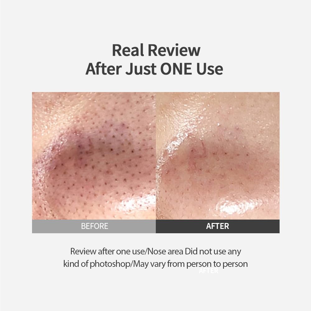 [SUNGBOON EDITOR] Blackhead Melting Clear Pad (30pads)