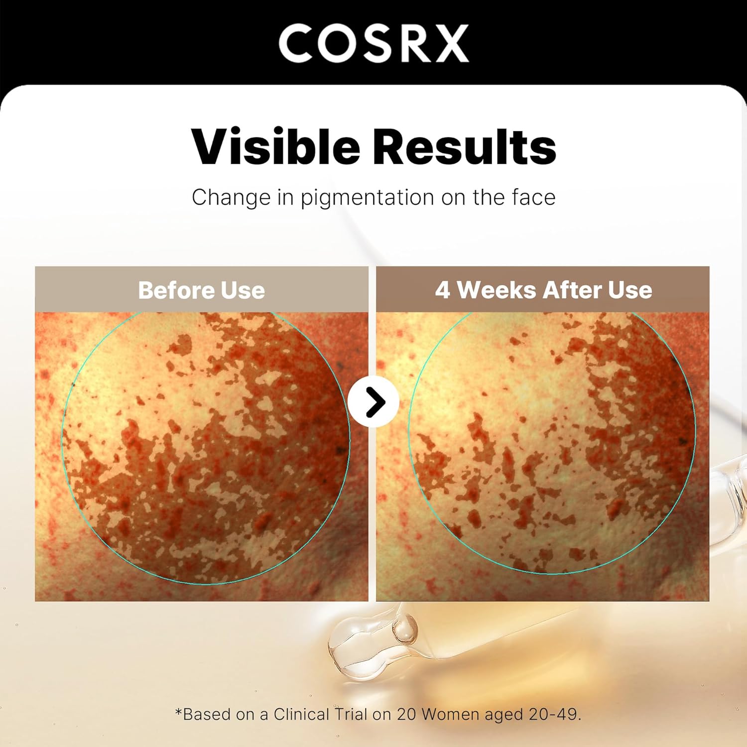 [COSRX] The Alpha-Arbutin 2 Discoloration Care Serum 50ml