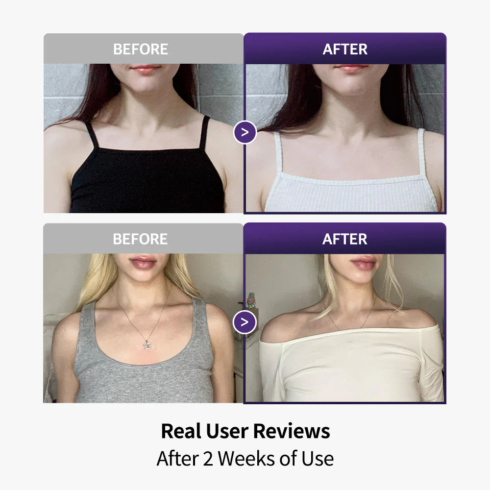 [essl] Trapezius Patch (10ea)