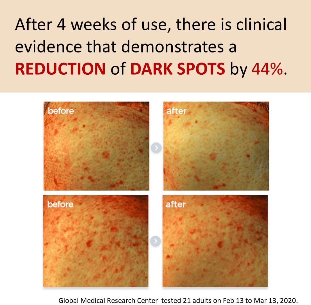 [make p:rem] Poncirus Trifoliata C Dark Spot serum 40ml
