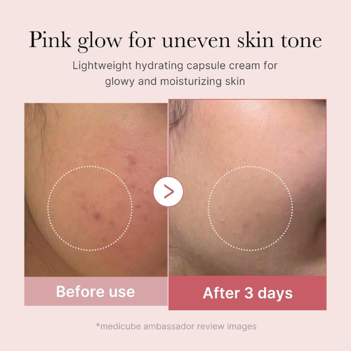 *MOIDA SET* [MEDICUBE] PDRN Pink Miracle Set (Serum + Cream)