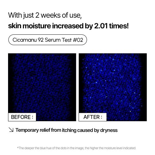[PARNELL] *renewal* Cicamanu 92 Serum 30ml
