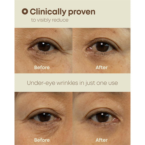 [NINE LESS] Ever-Youth Dual Effect Eye Cream 20ml
