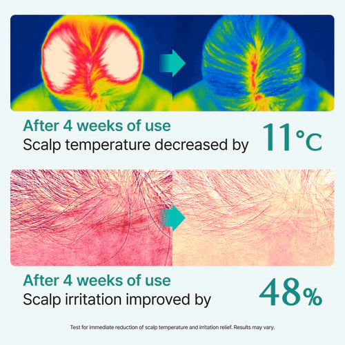 MOIDA SET [MOIDA] Viral Scalp & Root Strengthening Duo (lilyeve + Seapuri) *Special Price*