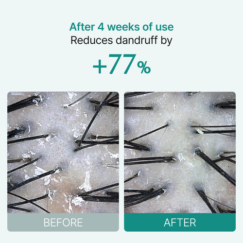 [Lilyeve] Scalp:Turn Cica PDRN Brush Ampoule 30ml